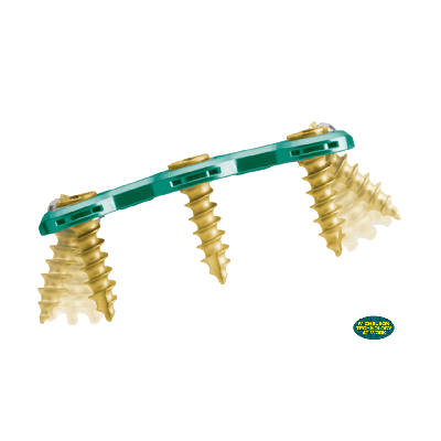 Maxan Green Cerv Plate Midline Maxan Green 3 Lvl 66MM Fix Plt [Pack of 1]