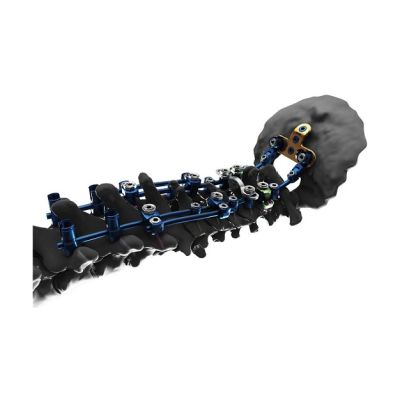 4.0X14MM Pa Screw Virage Gold [Pack of 1]