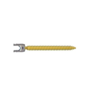 Vitality 8.5X100MM Opn Iliac Scr Vitly [Pack of 1]