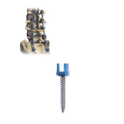 Polyaxial Trans 5.5 TI 8.5X40MM Trns [Pack of 1]