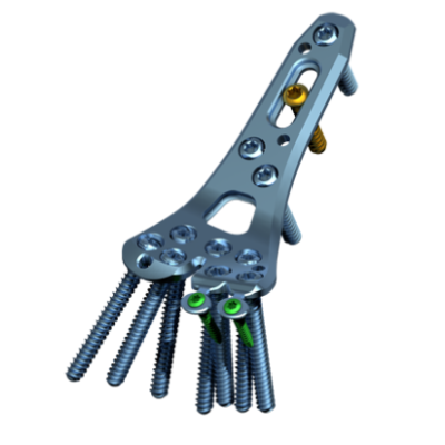 Aptus 2.5 Adaptive Trilock Dist.Rad.Pl Volar R [Pack of 1]