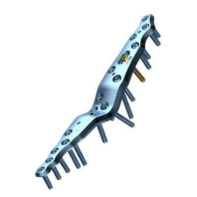 Aptus 2.5 Trilock Total Wrist Fus.Pl Long Bend [Pack of 1]