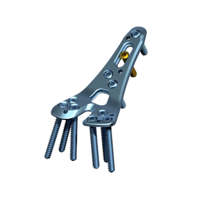 Medartis 2.5 Trilock Dist.Rad.Corr.Pl Volar Left, A-4750.25 [Pack of 1]