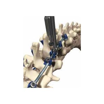 Polyaxial 5MM Virage Hook [Pack of 1]