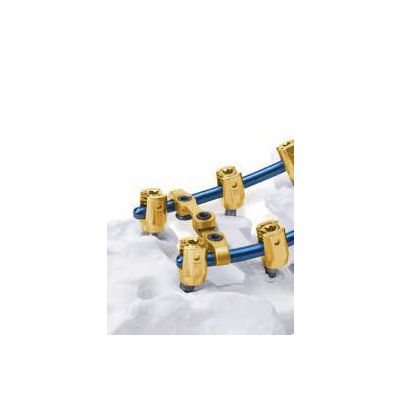 Associated Product Array 5.5 TI Poly Scr 7.5X70MM [Pack of 1]