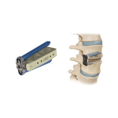 Anchored Timberline Screw Self Tapping TI 6.0X40MM [Pack of 1]