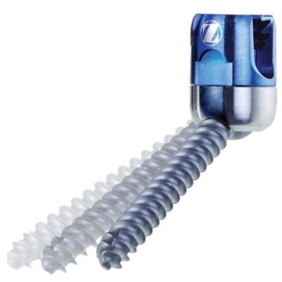 Polyaxial 3.5X43MM Pa Screw Virage Blue [Pack of 1]